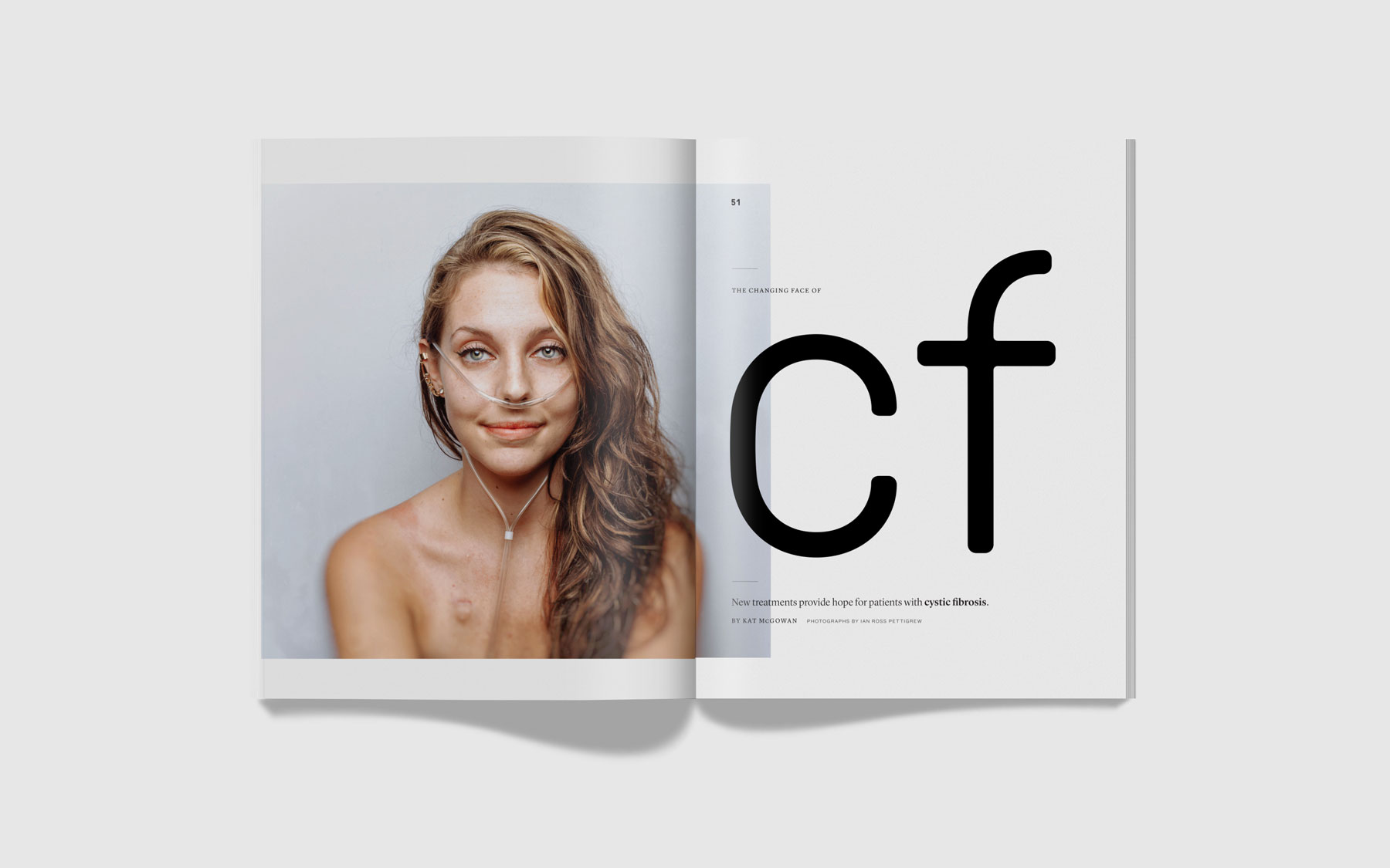 Genome Cystic Fibrosis feature