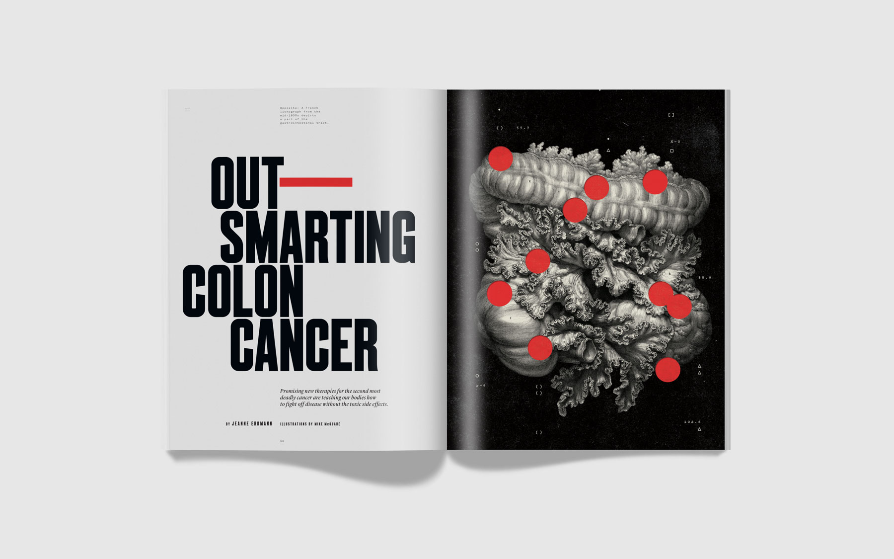 Genome Colon Cancer feature